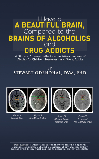 Cover image: I Have a Beautiful Brain, Compared to the Brains of Alcoholics and Drug Addicts 9798889109891