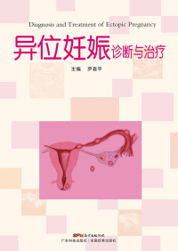 Titelbild: 异位妊娠诊断与治疗 1st edition 9787535964526