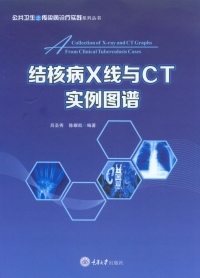 Cover image: 结核病X线与CT实例图谱 1st edition 9787568909198