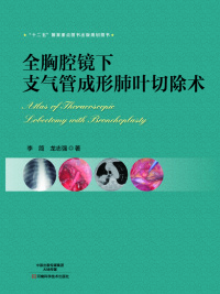 Immagine di copertina: 全胸腔镜下支气管成形肺叶切除术 1st edition 9787534976162