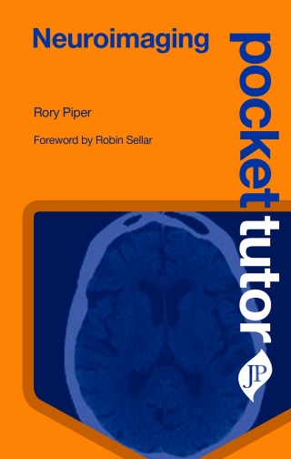 Cover image: Pocket Tutor: Neuroimaging 1st edition 9781909836570