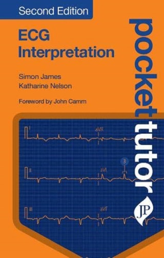 Cover image: Pocket Tutor: ECG Interpretation 2nd edition 9781909836716