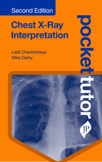 Cover image: Pocket Tutor: Chest X-Ray Interpretation 2nd edition 9781909836860