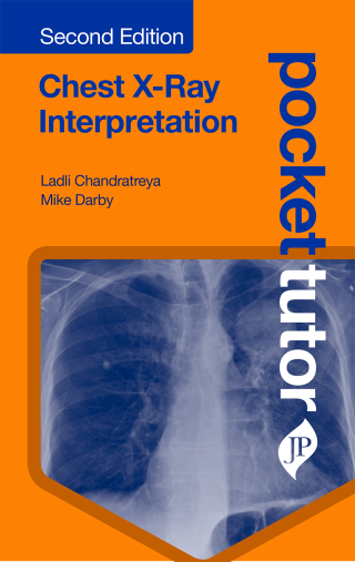 Imagen de portada: Pocket Tutor: Chest X-Ray Interpretation 2nd edition 9781909836860