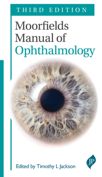 Cover image: Moorfields Manual Ophthalmology 3rd edition 9781909836945