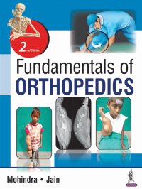 Imagen de portada: Fundamentals of Orthopedics 2nd edition 9789352701322