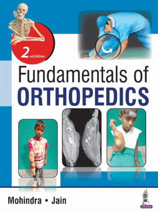 表紙画像: Fundamentals of Orthopedics 2nd edition 9789352701322